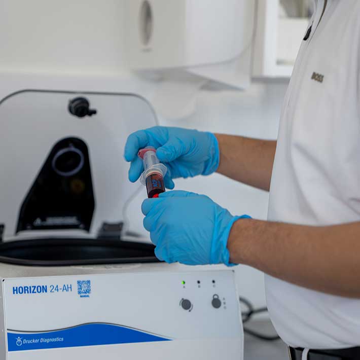 PRP-Therapie-Orthopaedie-Oda