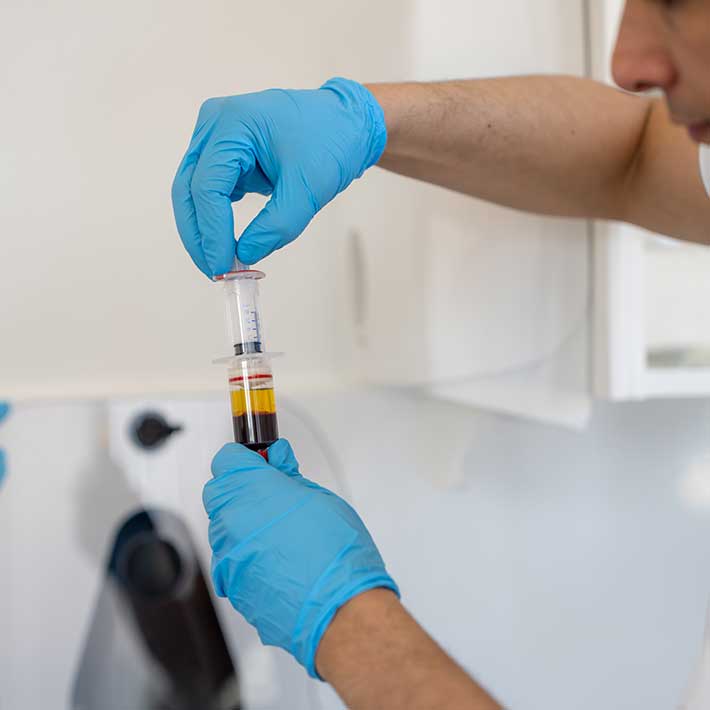 PRP-Therapie-Orthopaedie